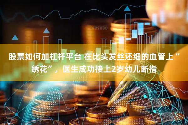 股票如何加杠杆平台 在比头发丝还细的血管上“绣花”，医生成功接上2岁幼儿断指